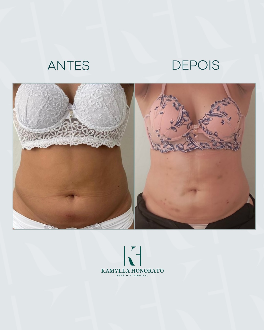 464778797_18071050447717741_5077555937365212693_n