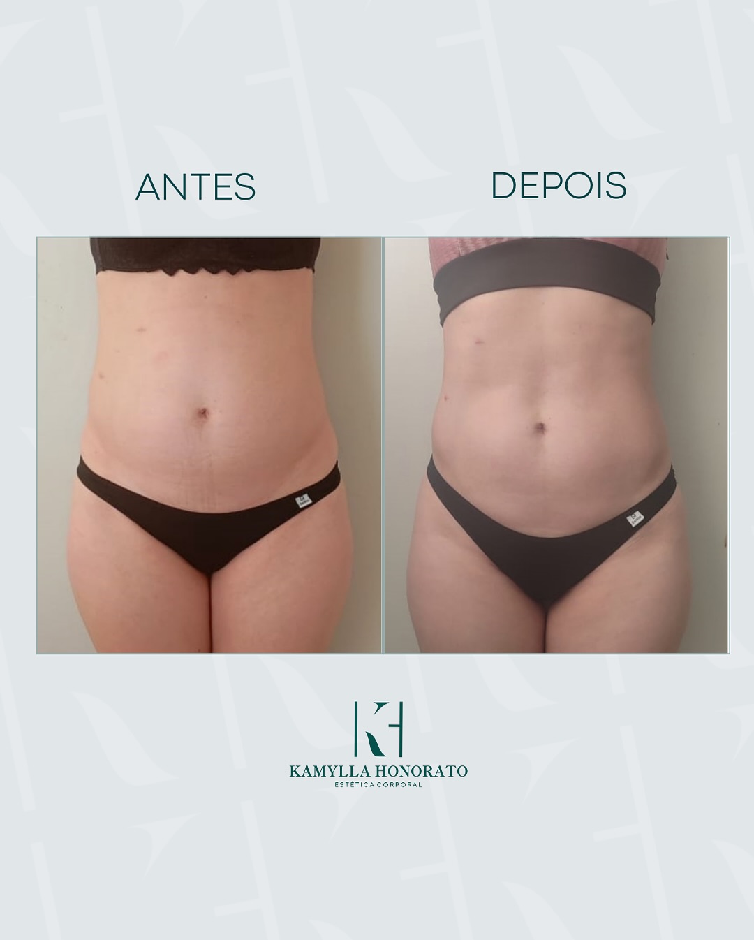 464952600_18071050411717741_2026469562111014286_n