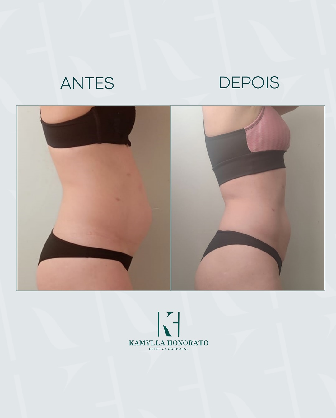 465050328_18071050402717741_396311538399385300_n